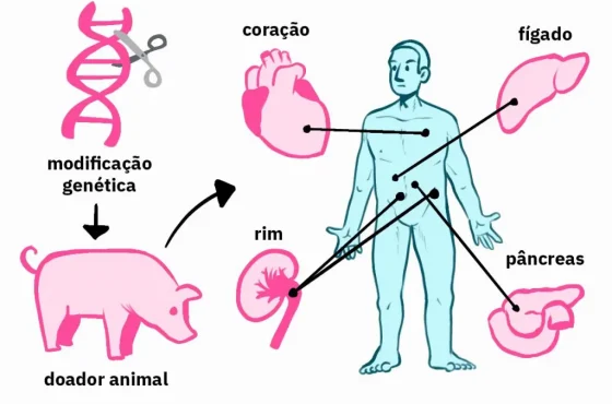 Xenotransplante